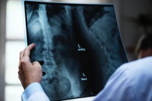 Spinal Cord X-Ray