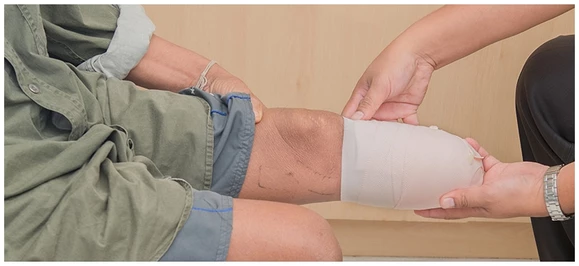 A man with his leg amputated in a bandage