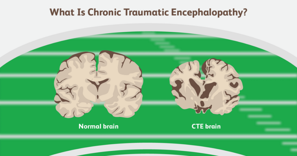 CTE stages