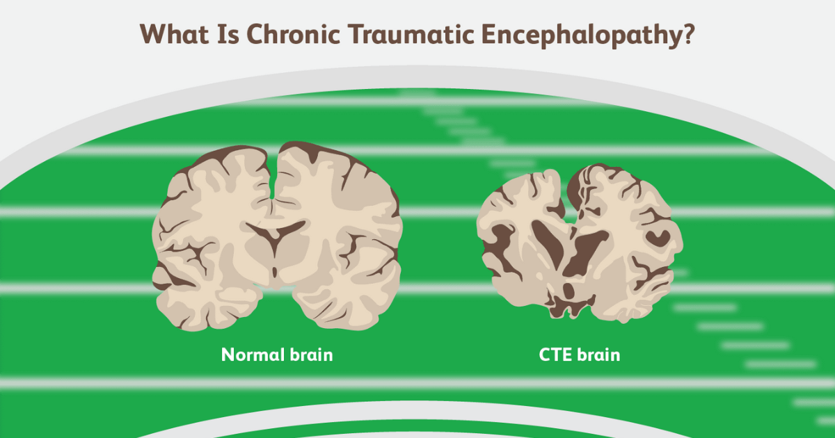What Is CTE and its Stages