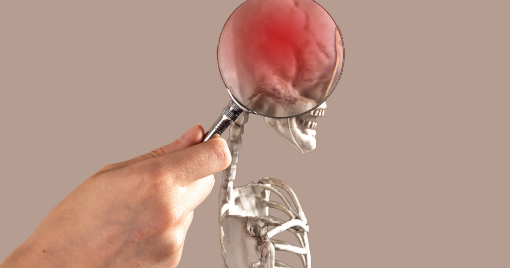 brain stem injury