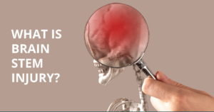 brain stem injury 1
