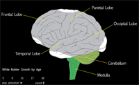 Example of a brain scan. Post concussion syndome