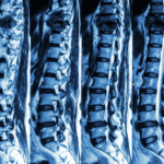 Paralysis Injury Lawyers: Supporting Families Through Life-Changing Moments 6